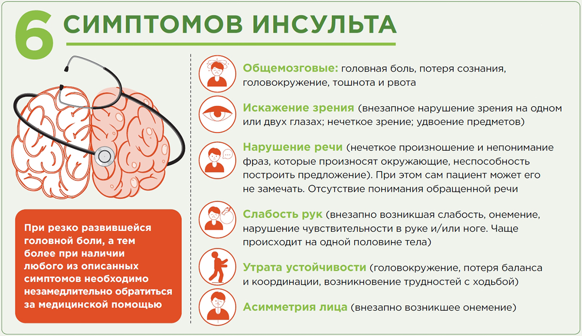 Шесть симптомов инсульта