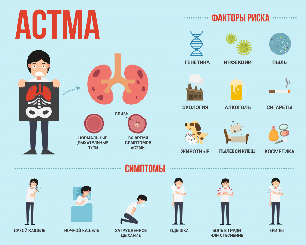 Астма