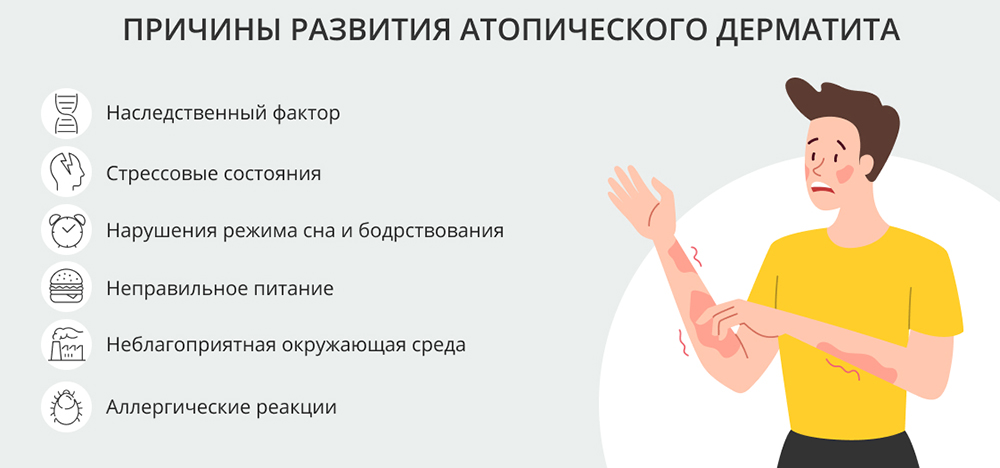 Причины развития атопического дерматита