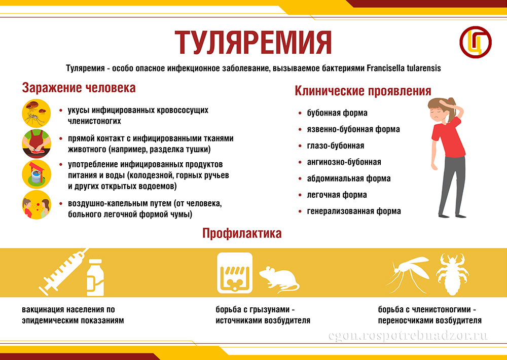 Туляремия