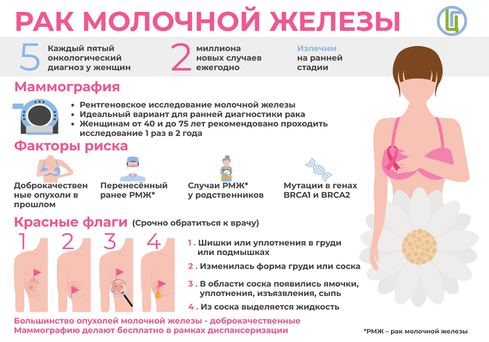 Рак молочной железы
