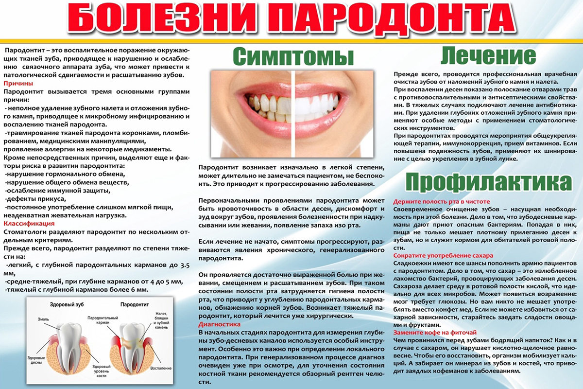 Болезни пародонта