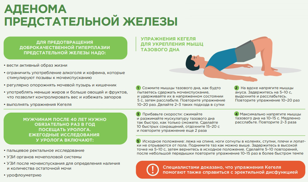 Аденома предстательной железы