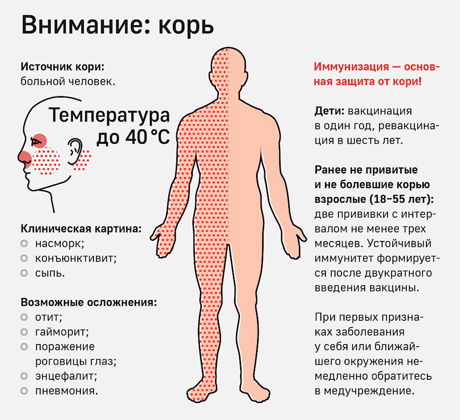 Внимание: корь