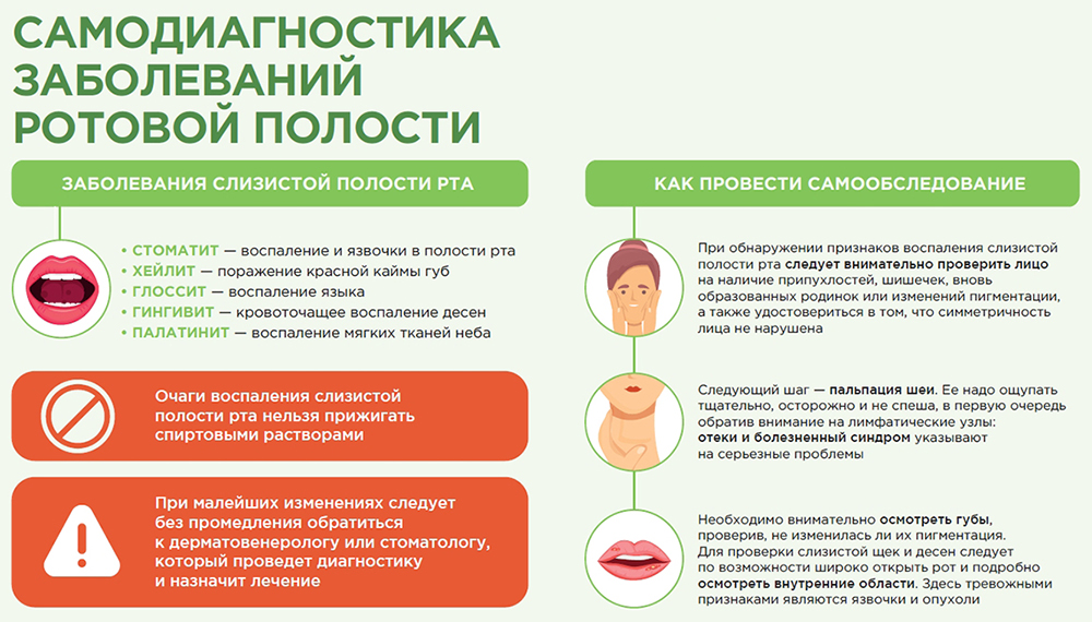Самодиагностика заболеваний ротовой полости