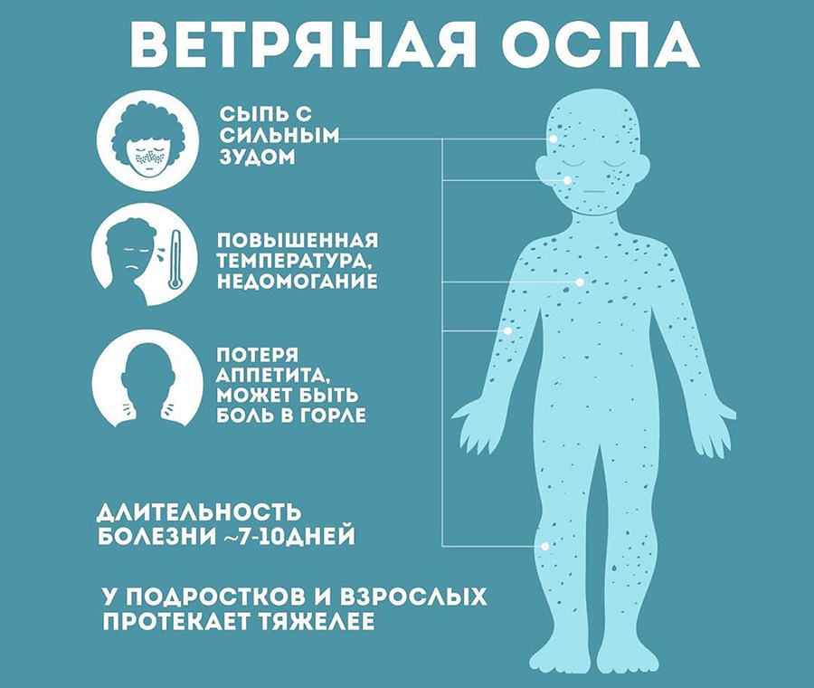 Ветряная оспа