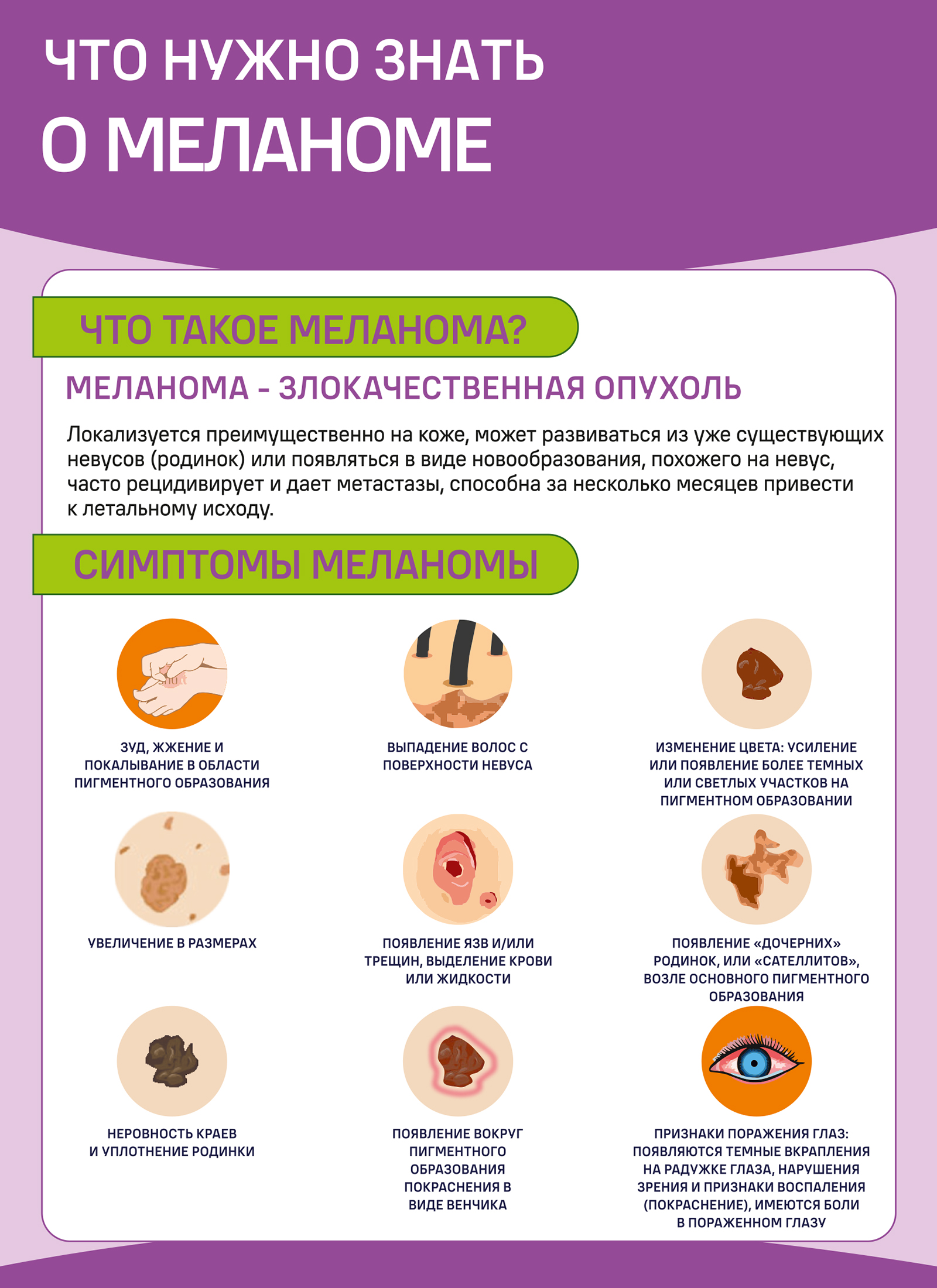 Что нужно знать о меланоме