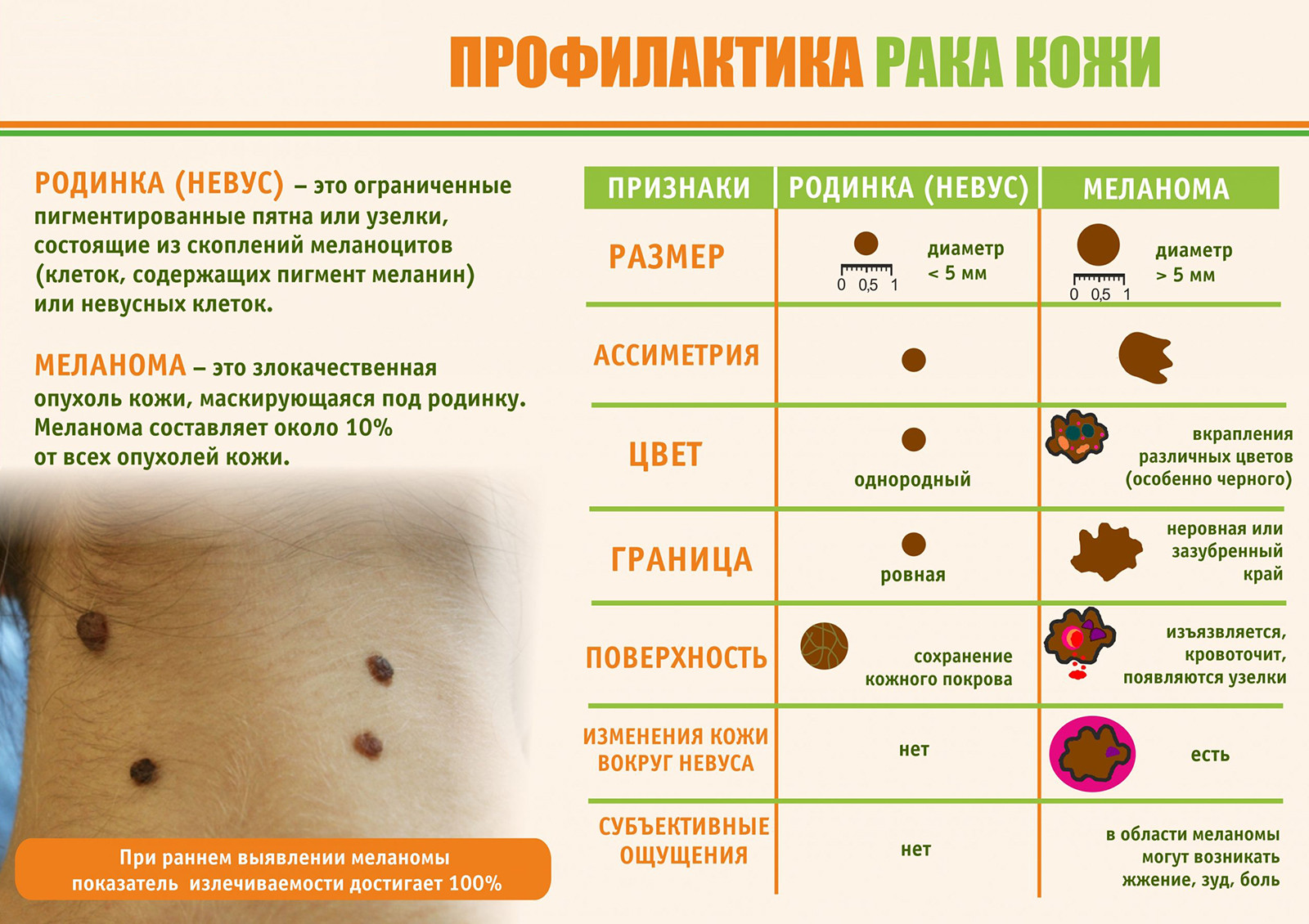 Профилактика рака кожи