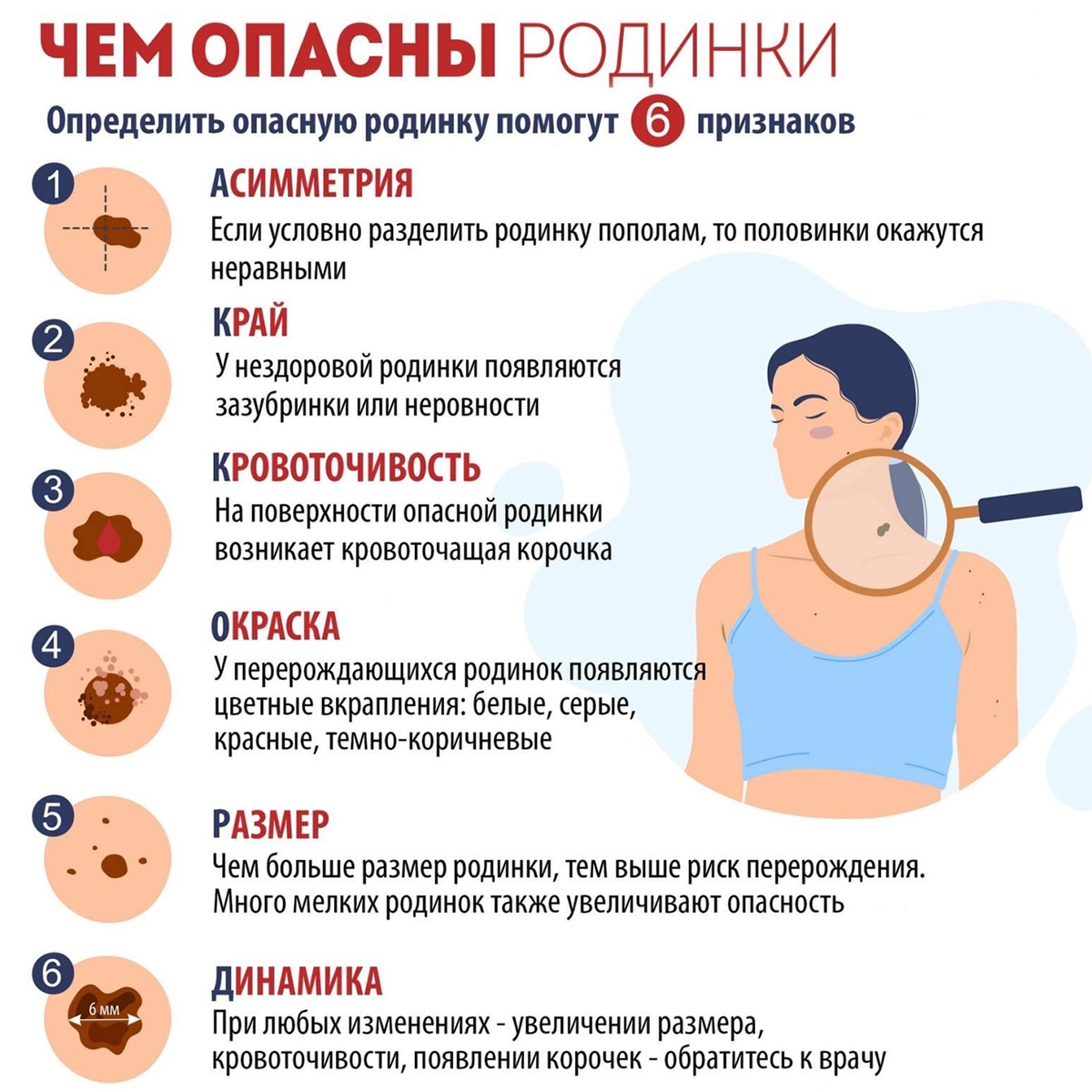 Чем опасны родинки