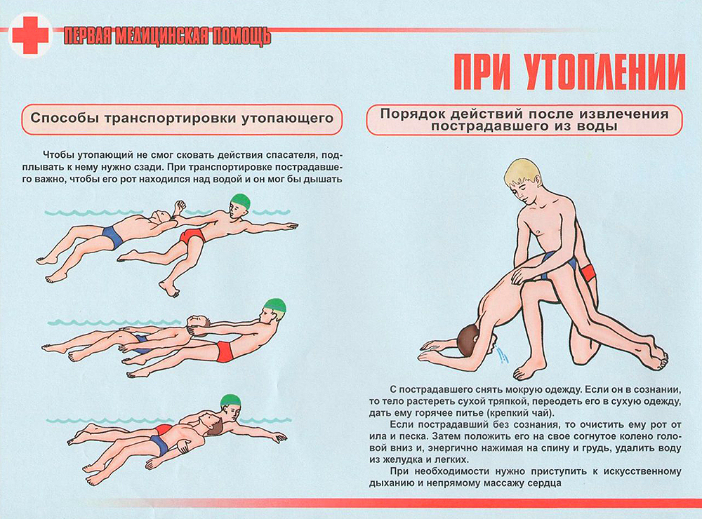 Первая медицинская помощь при утоплении
