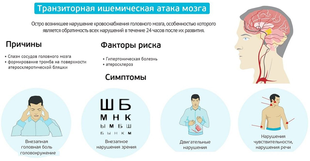 Транзиторная ишемическая атака мозга