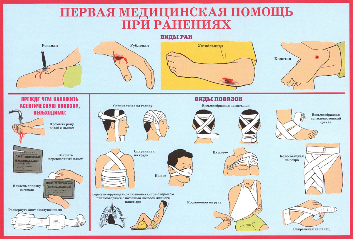 Первая медицинская помощь при ранениях
