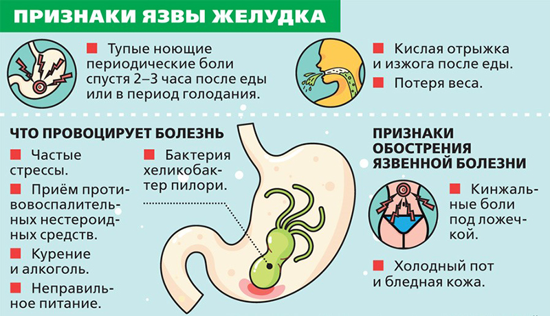 Признаки язвы желудка